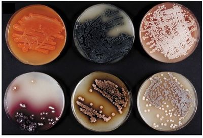 Streptomyces slides